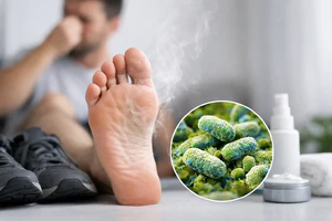 Foot Odor Caused by Bacteria: What Helps?