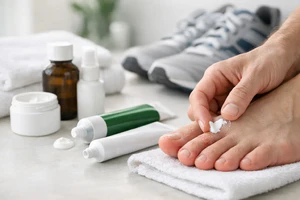 Best OTC Antifungal Ointments for Athlete’s Foot